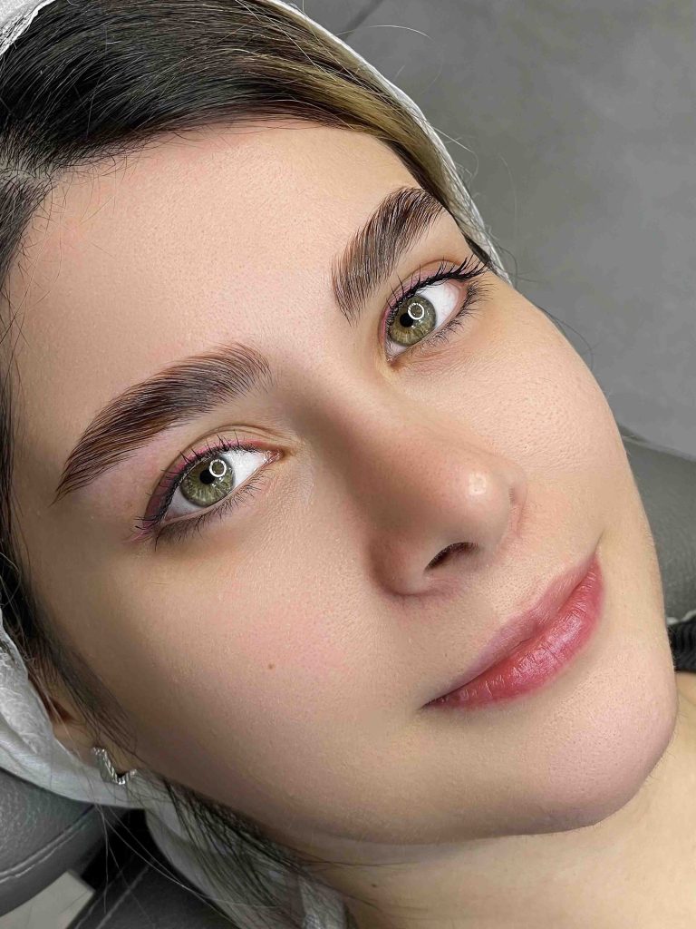 نمونه کار لیفت ابرو رشت