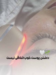 پاکسازی پوست رشت
